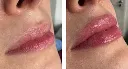 web_servicios_dr_carlos_carvajal_labios.webp