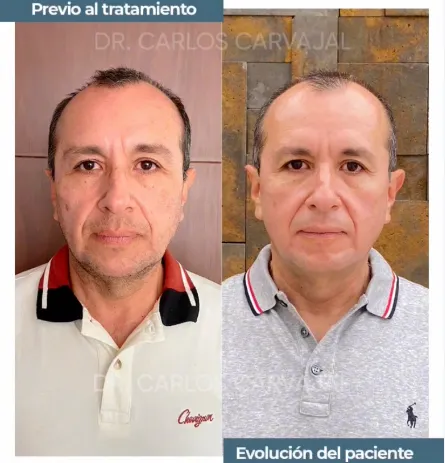 manejo_manchas.webp