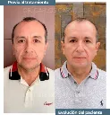 manejo_manchas.webp