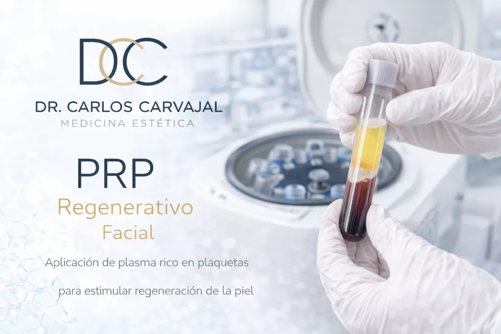 PRP regenerativo.webp